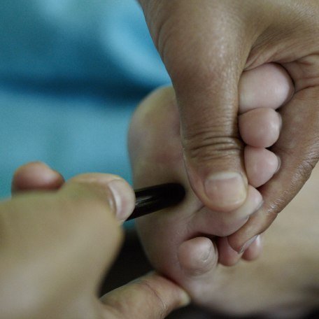 anwendungen-bak-21_2, &copy; Laddy&acute;s Thai Spa